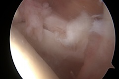 slika-1-operacijska-slika